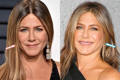 jennifer aniston before and after|jennifer aniston plastic surgery timeline.